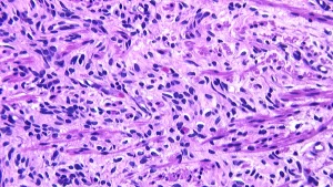 Sakatlık: Biyomekanik, Anatomik ve Antrenman Faktörleri